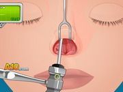 Operate Now Nose Surgery