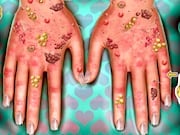Ugly Hands Doctor